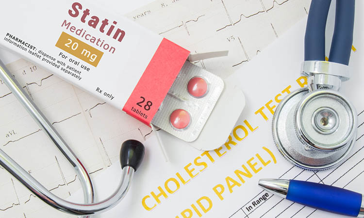 Offene Verpackung mit Medikamententabletten, auf der „Statin Medication“ steht, liegt in der Nähe von Stethoskop, Ergebnisanalyse zu Cholesterin (Lipidpanel) und EKG