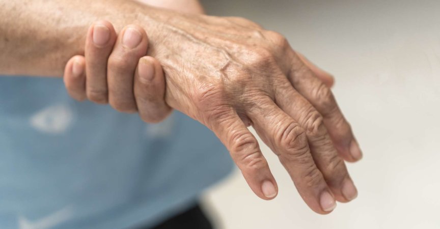 Guillain-Barre-Syndrom GBS, periphere Neuropathie Schmerzen bei älteren Patienten an Hand, Fingern, sensorischen Nerven mit taub, Muskelschwäche durch chronisch entzündliche demyelinisierende Polyneuropathie