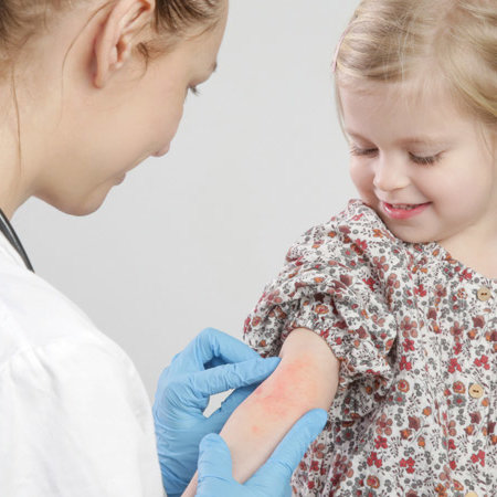 Ärztin behandelt rote und juckende Ekzeme auf dem Arm eines kleinen Mädchens