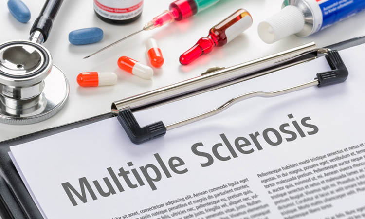 The diagnosis Multiple Sclerosis written on a clipboard