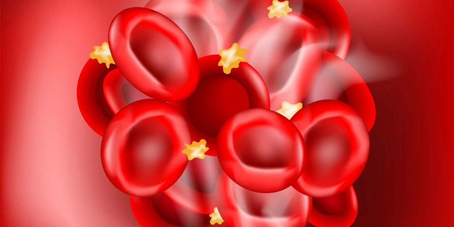 Blutgerinnsel auf rotem Hintergrund. Thrombus, der ein Blutgefäß verstopft hat. Blutgerinnung. Hämostase. Vektor-Illustration