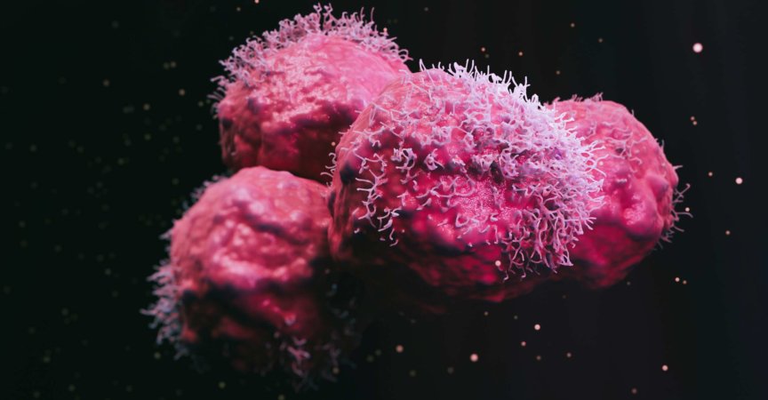 Bösartige Krebszellen