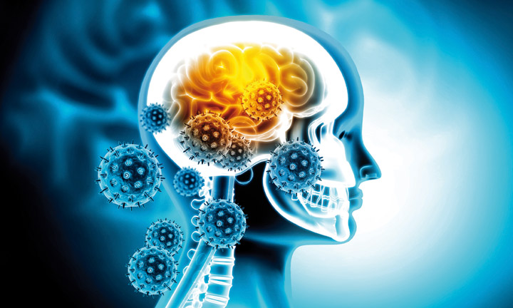Illustration eines Kopfes im Profil mit dessen Schädel und Gehirn und Viren, die darauf zu fliegen
