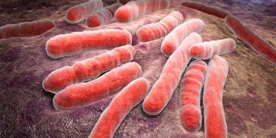 3D-Darstellung einer bakteriellen Infektion von Tuberkulose
