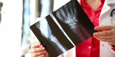 Female radiologist hold in hand x-ray film image aganist hospital office background. CT scan of bone health concept.