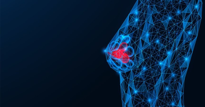 Vaginale Östrogene erhöhen potenziell das Rezidivrisiko beim HR+ Brustkrebs wenn sie mit Aromatasehemmern kombiniert werden.