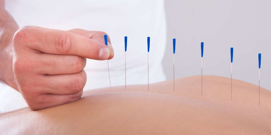 Junge schöne Frau in einer Akupunktur-Therapie in einem Spa-Center