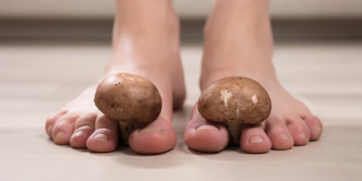 Close-up Of A Woman's Feet With Edible Mushrooms Between The Toes