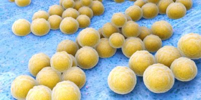 Staphylococcus aureus