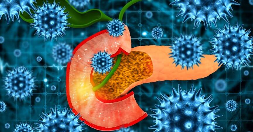 Bauchspeicheldrüse mit Viren und Bakterien. Konzept der Bauchspeicheldrüsenerkrankung. 3D-Darstellung