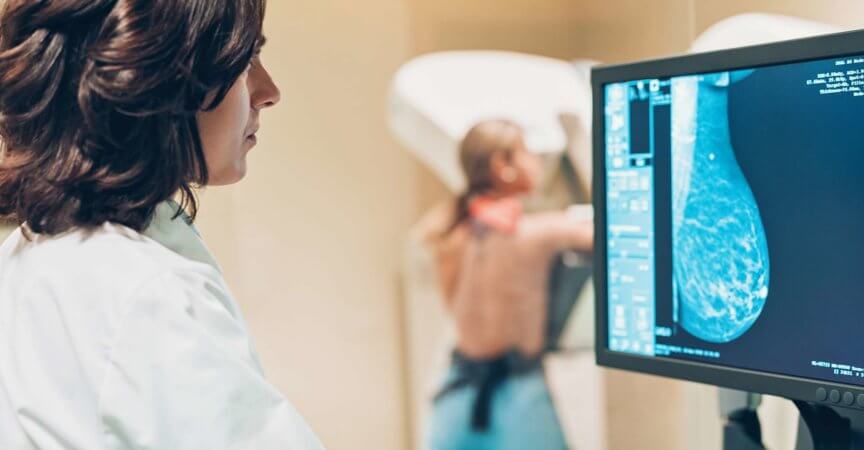 Arzt und Patient machen eine Mammographie