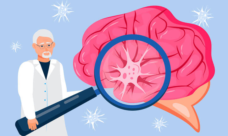 Themebild Multiple Sklerose: Illustration Neurologe untersucht grosses Gehirn mit Lupe