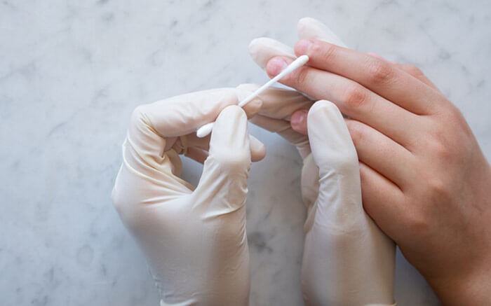 Medical Professional Treating Warts of Child"u2019s Fingers