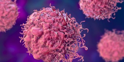 Krebszellen, bösartige Zellen, wissenschaftliche 3D-Darstellung