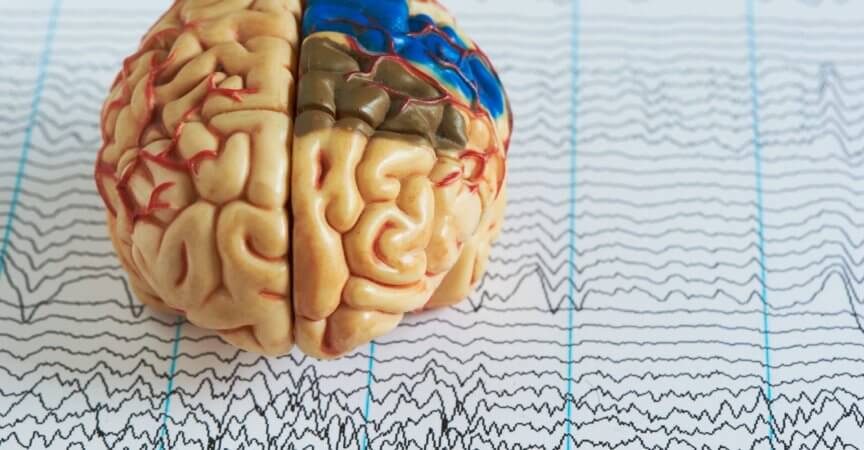 Human brain model on background of brain waves from electroencephalography