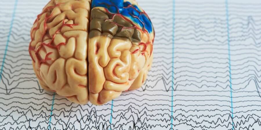 Human brain model on background of brain waves from electroencephalography