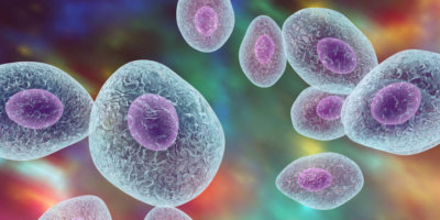 Kein Screening aber Prophylaxe ist möglich: Pneumo­cys­tis-jirovecii-Pneumonie