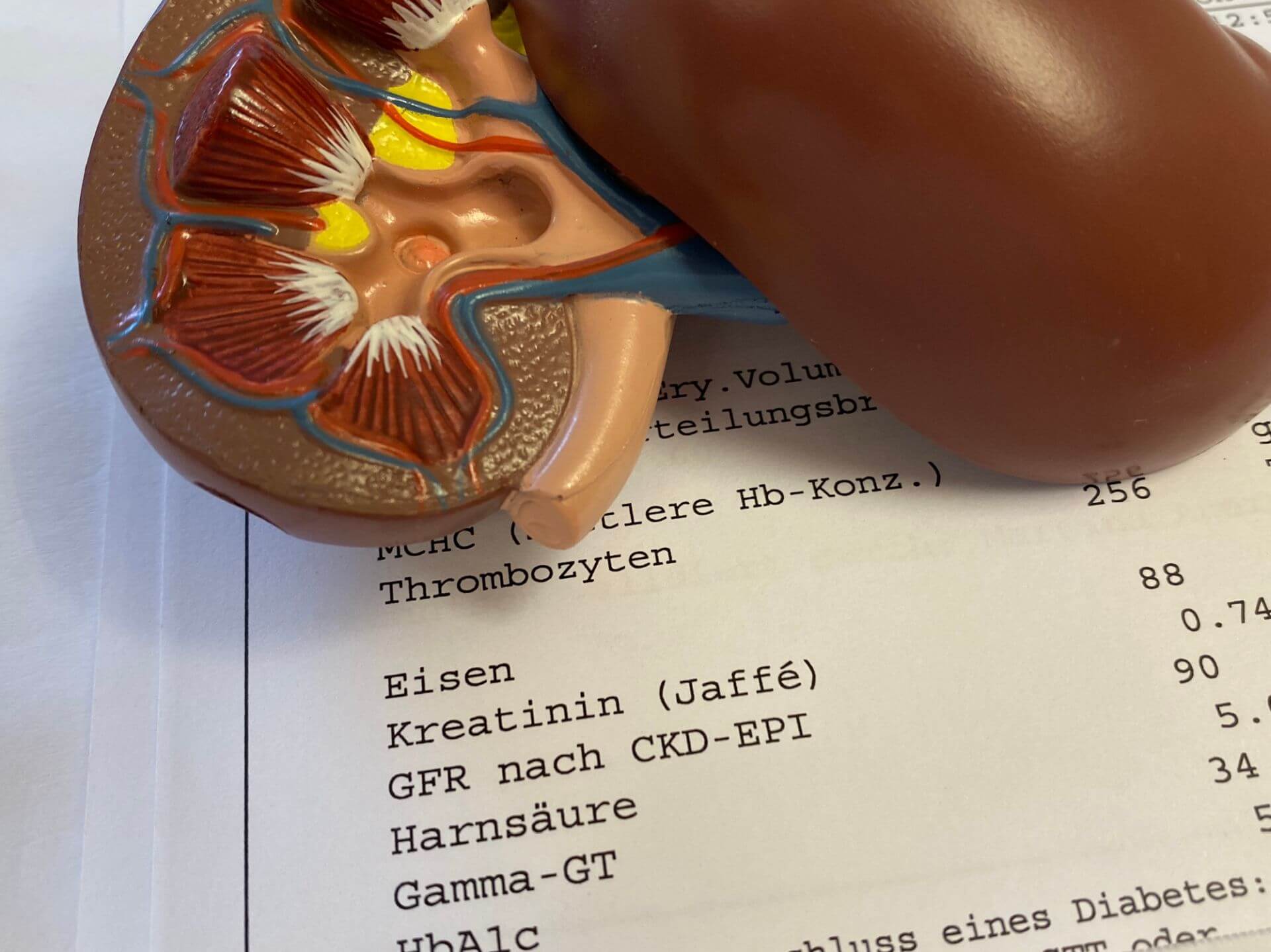 Herzinsuffizienztherapie: Vier Säulen helfen auch der Niere