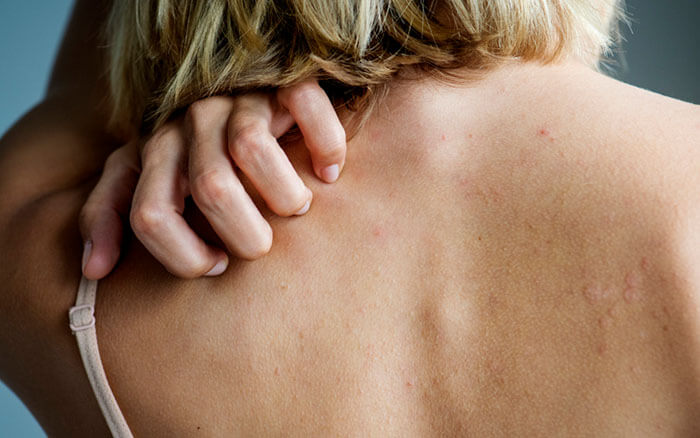 Rückseite des Rückenschmerz- und Schmerzkonzepts der weißen Frau