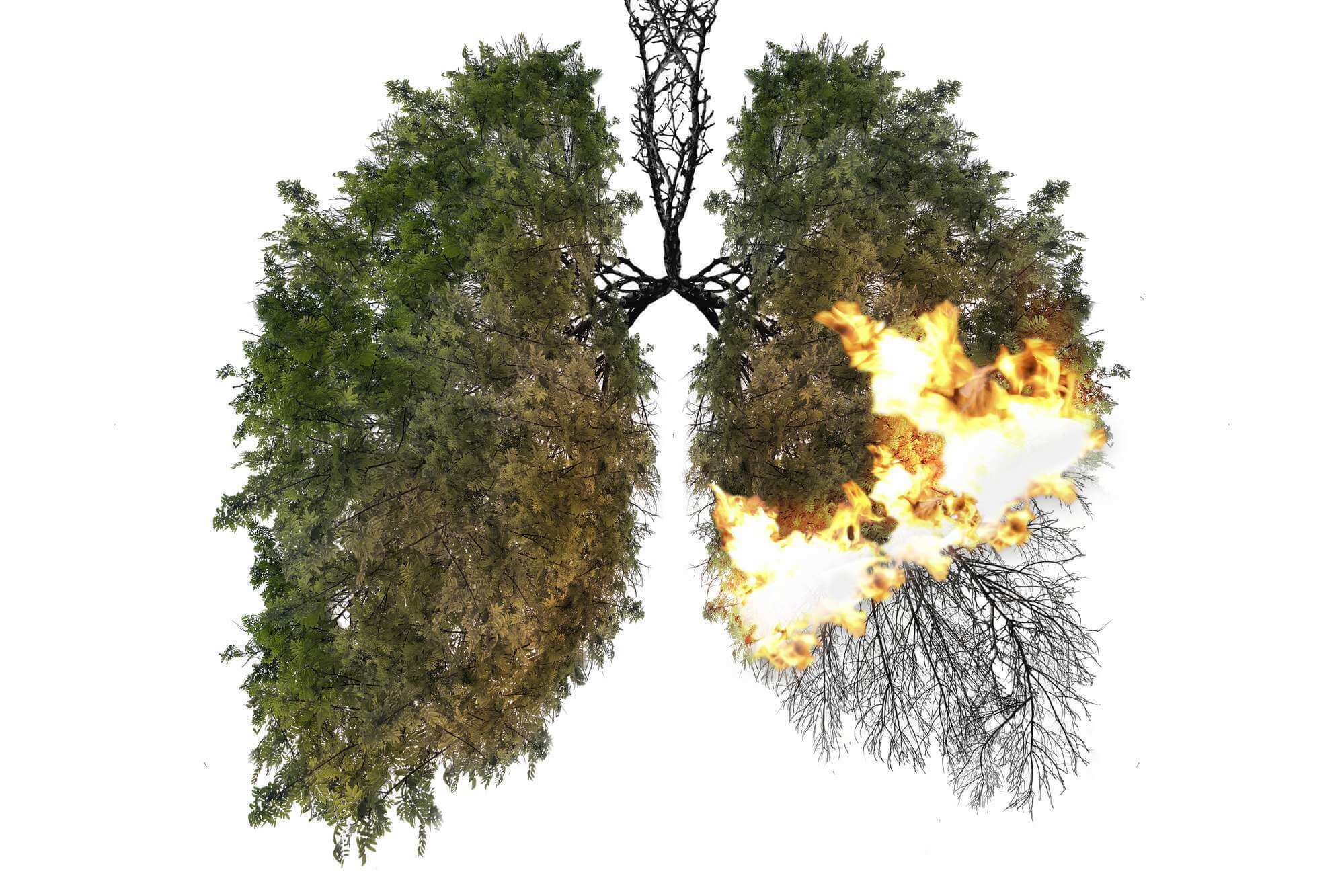 The Impact of Air Pollution and Climate Change on Lung Health: A Comprehensive Review