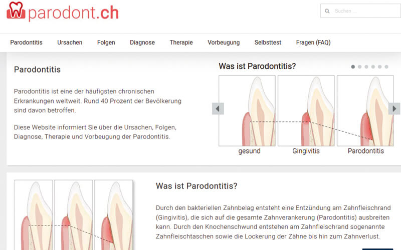 Www.parodont.ch Klärt Auf über Die Volkskrankheit Parodontitis ...