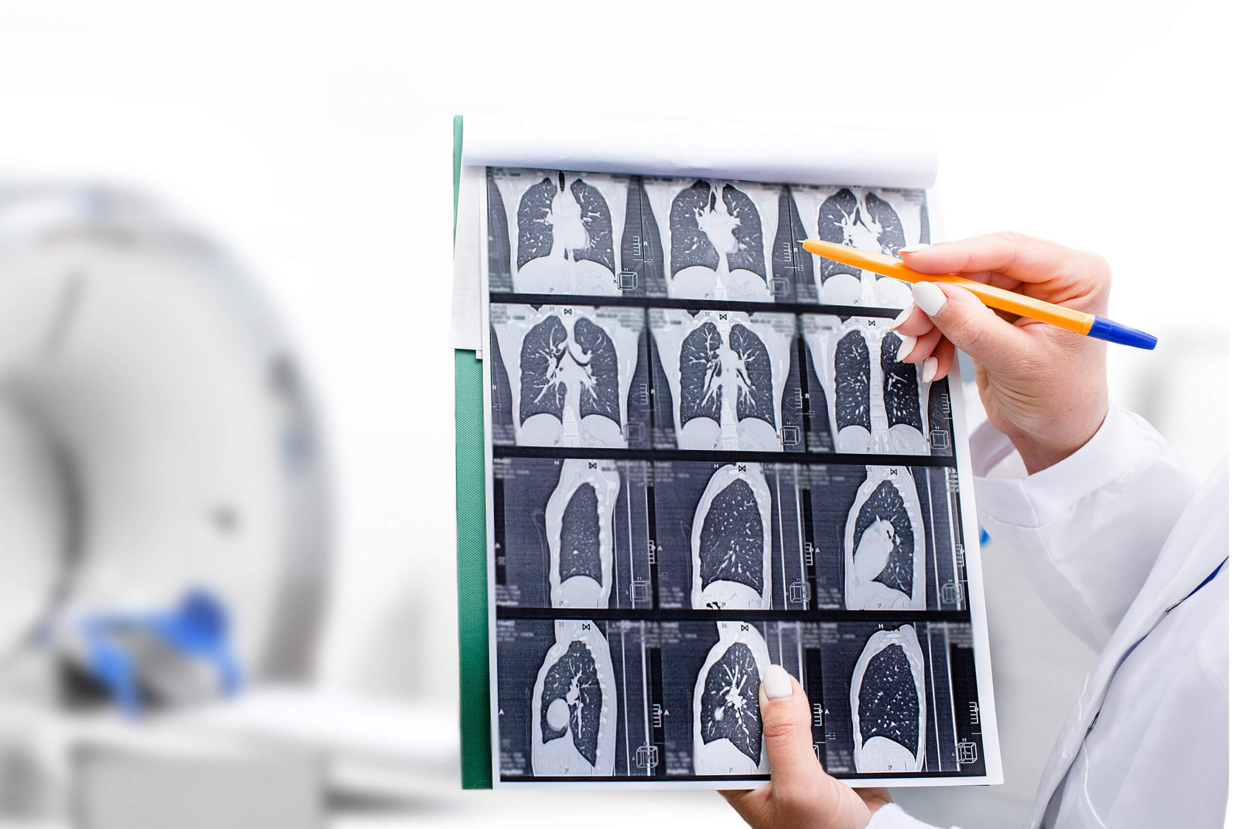 Rundherd-Zufallsbefund in der Thorax-CT