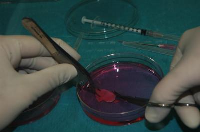 Ovarialgewebe in einer Petrischale vor der Kryokonservierung