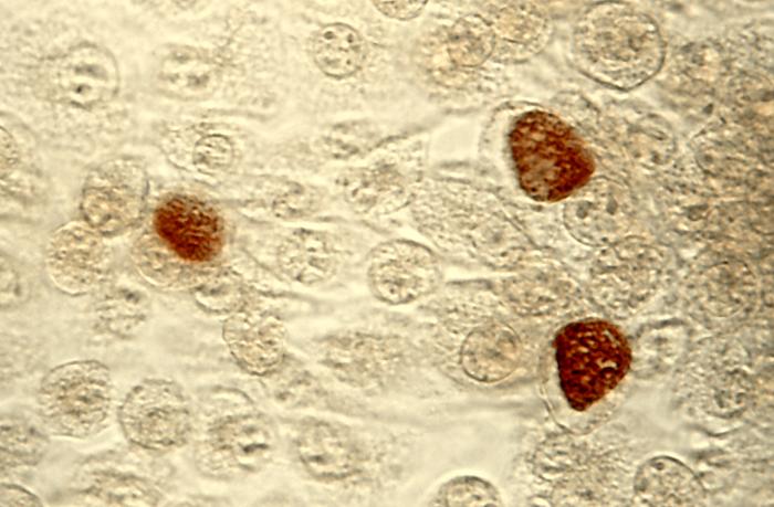 Chlamydia Trachomatis Einschlusskörperchen
