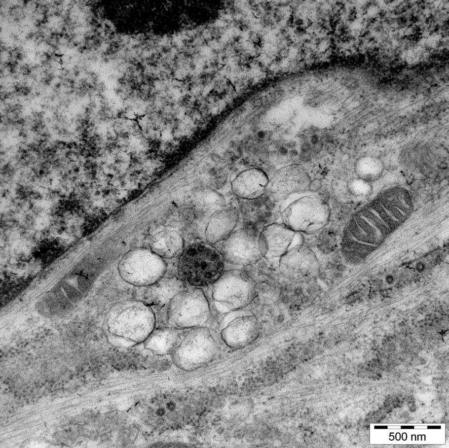 Elektronenmikroskopische Aufnahme einer Coronavirus-infizierten Zelle mit zahlreichen Membranvesikeln, an denen sich die Coronaviren vermehren. Die Bildung dieser Membranvesikel wird durch den neuartigen Blocker gehemmt.