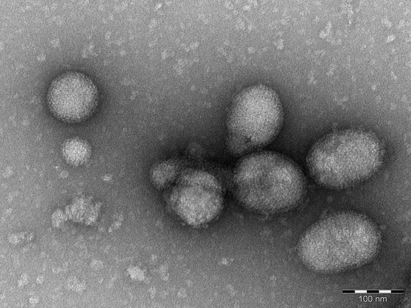 Elektronenmikroskopische Aufnahme des Ferak-Virus. Ferak ist eine Fantasiegestalt, ein Mischwesen aus Pflanze und Tier. Das Genom des Virus weist Ähnlichkeiten zu Bunyaviren sowohl aus Pflanzen als auch aus Tieren auf.