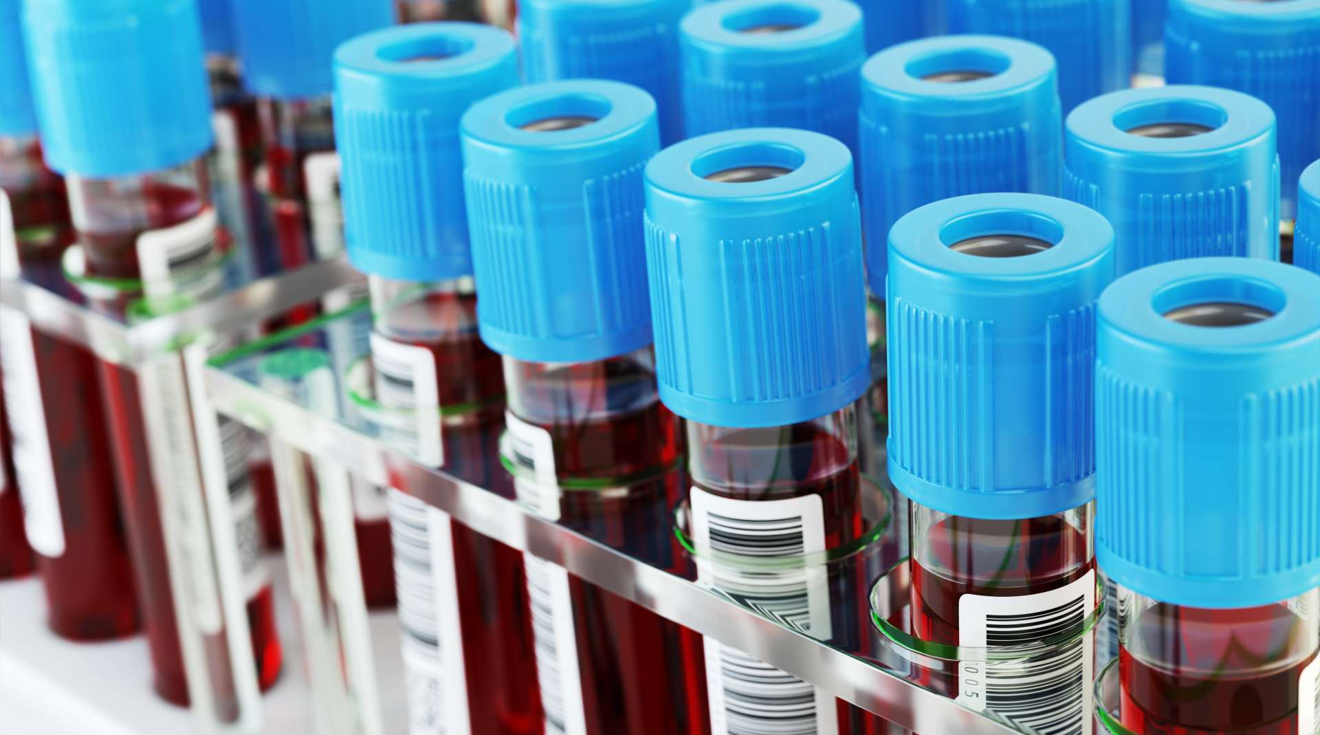 Blood Test Shows Promising Results as a Detection Tool for EarlyStage