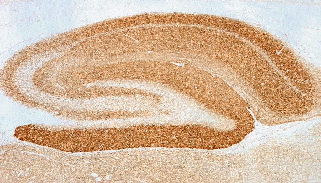Der Liquor eines Patienten mit NMDAR-Enzephalitis zeigt im tissue-based assay im Hippocampus ein kräftiges Neuropilfärbemuster.
