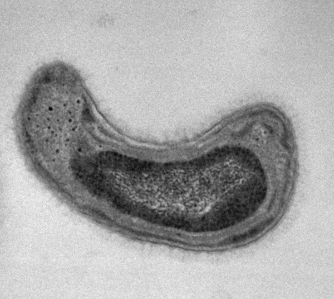 Methanobactin bei Morbus Wilson