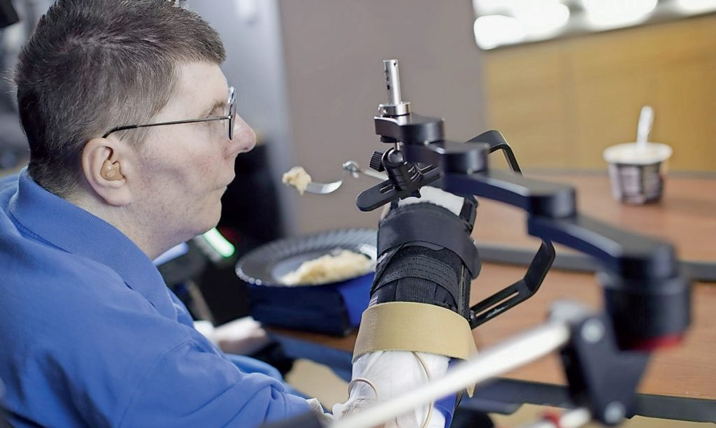 Acht Jahre war dieser Patient vollständig gelähmt: Mit einer Neuroprothese kann er wieder selbstständig Kartoffelpüree essen.