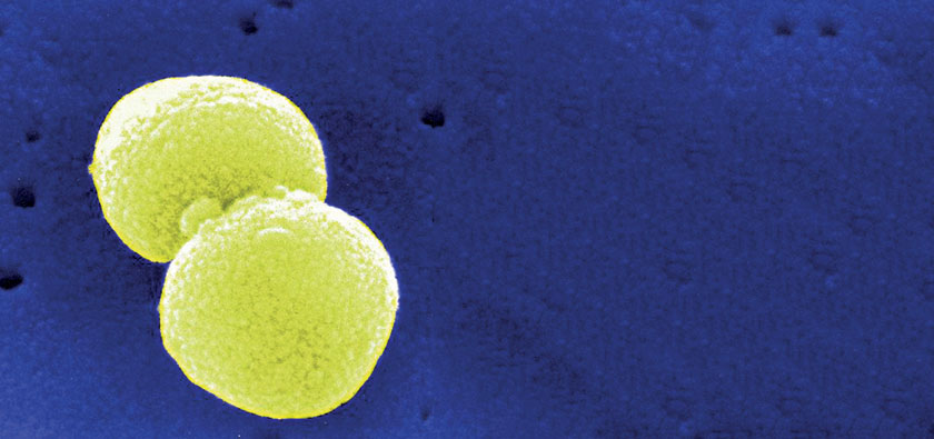 Streptococcus pneumoniae: einer der häufigsten bakteriellen Erreger der CAP 