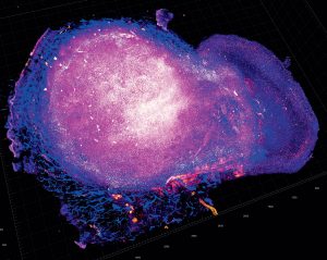 Foto: Steve Seung-Young Lee/National Cancer Institute – Univ. of Chicago Comprehensive Cancer Center T-Zellen attackieren nach einer Behandlung mit Immun-Checkpoint-Inhibitoren den Tumor (Mausmodell)
