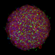 Langerhans'sche Insel mit Beta-Zellen, grün:Zilien, blau: Zellkerne, rot: Insulin. 
