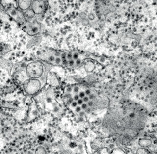 Erreger: Vier eng verwandte RNA-Viren (Dengue-Virus) des Genus Flavivirus 