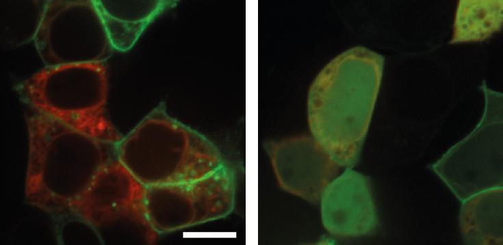 Der toll-ähnliche Rezeptor 2 liegt normalerweise an der Zellmembran (grüne Strukturen im linken Bild). Allerdings kann ein KSHV Protein die Lage beeinflussen wie im rechten Bild zu erkennen ist. Die rote Struktur zeigt das endoplasmatische Retikulum. 