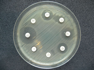 Resistenztestung: Kultur eines ESBL-bildenden E. coli 