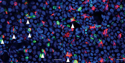 Deletion von LAMTOR2/p14 beeinträchtigt die Proliferation von Langerhans-Zellen in situ. Konfokalmikroskopische Analyse der Epidermis einer sieben Tage alten LAMTOR2/p14-defizienten Maus. Langerhans-Zellen wurden für die Expression von MHC Klasse II (rot) und Phosphor-Histon H3 (grün) gefärbt. Die weißen Pfeile verdeutlichen sich teilende, Phosphor-Histon-H3-exprimierende LZ (Maßstabsbalken: 20μm). 