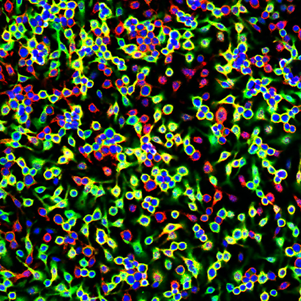 Fluoreszenzmikroskopische Aufnahme von Makrophagen (rot: Makrophagen-Marker, grün: Ferritin). Im Vergleich mit den wenigen Kontollzellen im Bild bilden Makrophagen mit IRP-Defekt deutlich mehr vom Eisenspeicher Ferritin (grün), den Salmonellen plündern können.