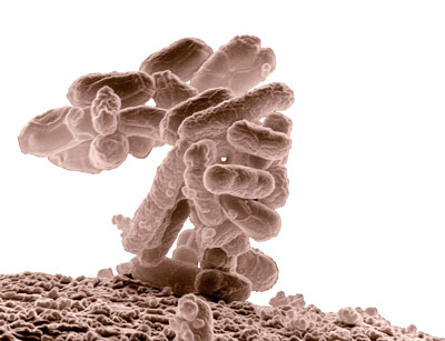 Mikrobiom (im Bild Escherichia coli) beeinflusst möglicherweise Wirbelsäulenerkrankungen 