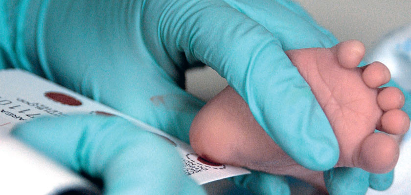 Fersenblutentnahme für das Neugeborenenscreening, unter anderem auf Phenylketonurie 
