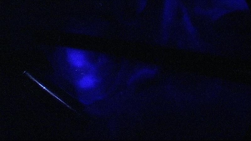 Mit dem fluoreszierenden Farbstoff ICG machen die Forscher die Wächterlymphknoten sichtbar (auf dem Bild sieht man zwei).